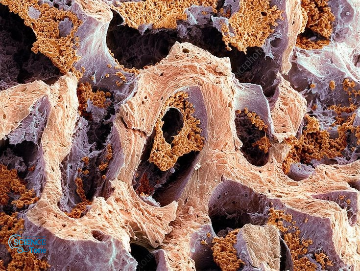 ما-هو-نخاع-العظم-وعلاقته-بتكوين-خلايا-الدم ؟