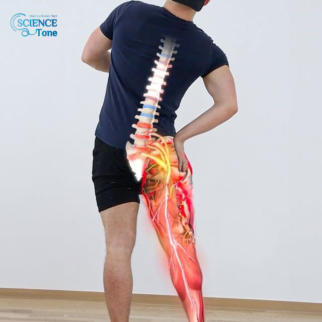 كيف-تتخلص-من-آلام-عرق-النسا-بواسطة-العلاج-الطبيعي